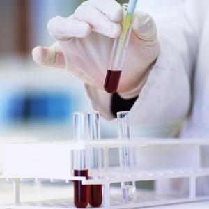连续工艺如何促进生物制药生产？